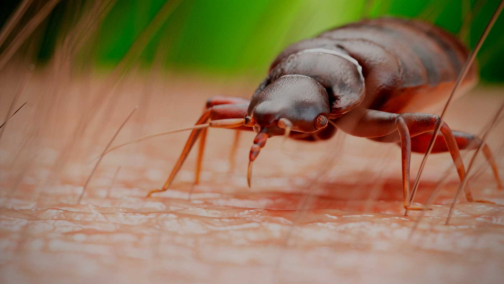 Can Bed Bugs Live In Your Brain