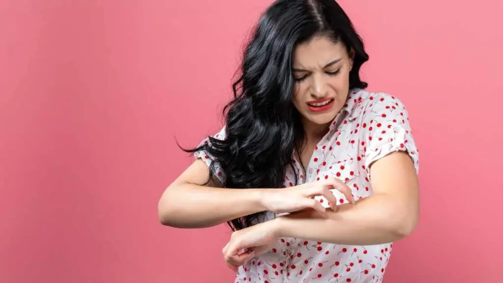 lady scratching mosquito bites